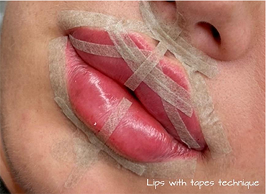 O 0844 25 image1 web