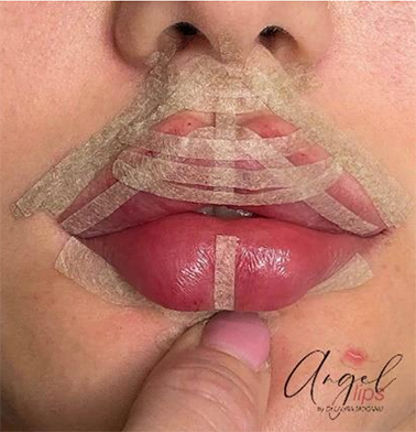 O 0844 25 image3 web